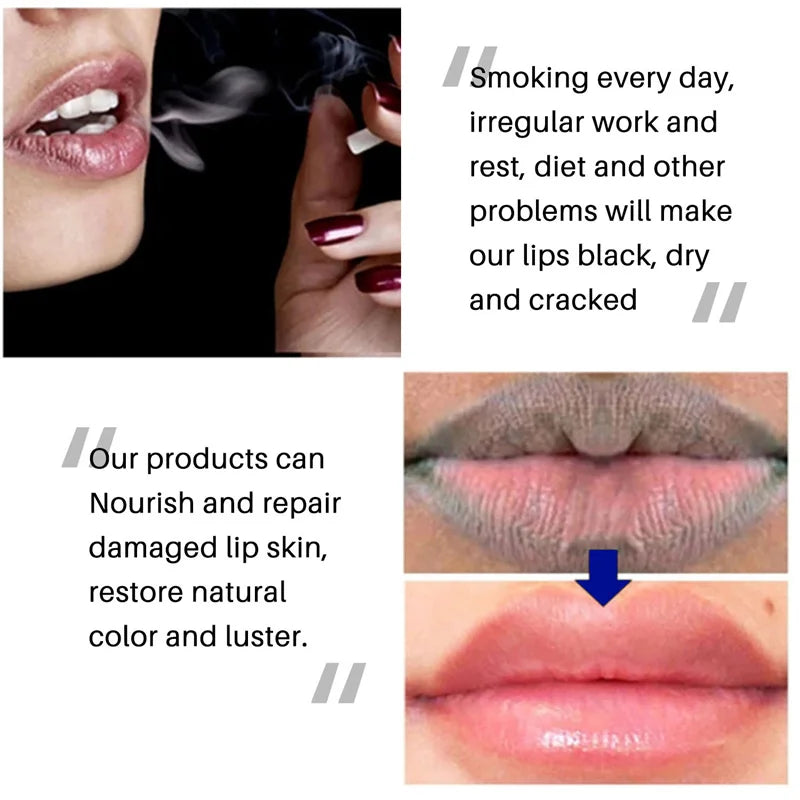 Lip Balm Remove Dark Lightening Melanin Mask Gloss