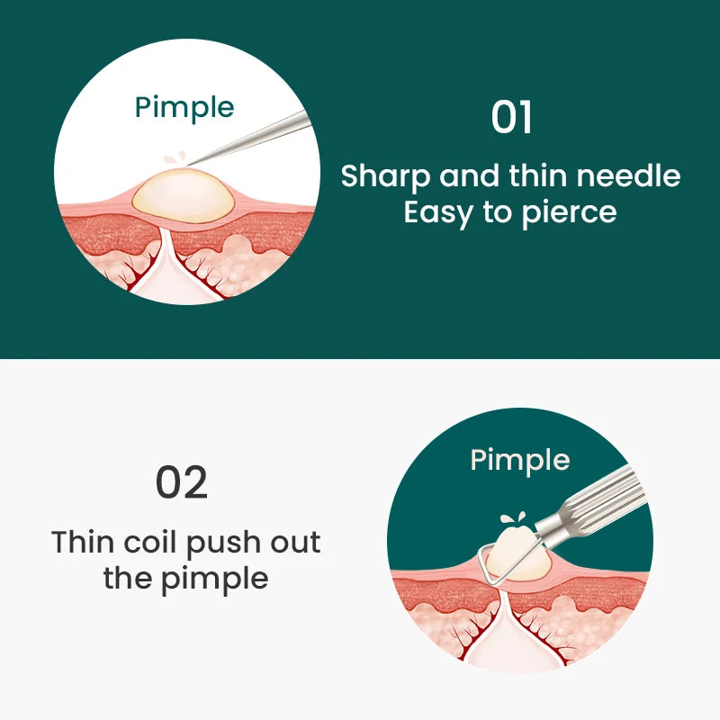 MR.GREEN Blackhead Remover Acne Removal Needle Professional Pimple