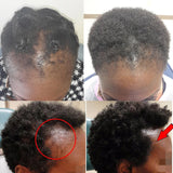 New Fast Hair Growth Serum 100% African Crazy