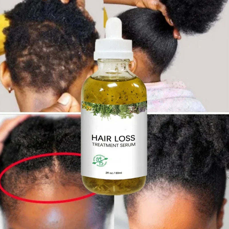 New Fast Hair Growth Serum 100% African Crazy