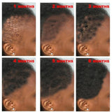 New Fast Hair Growth Serum 100% African Crazy