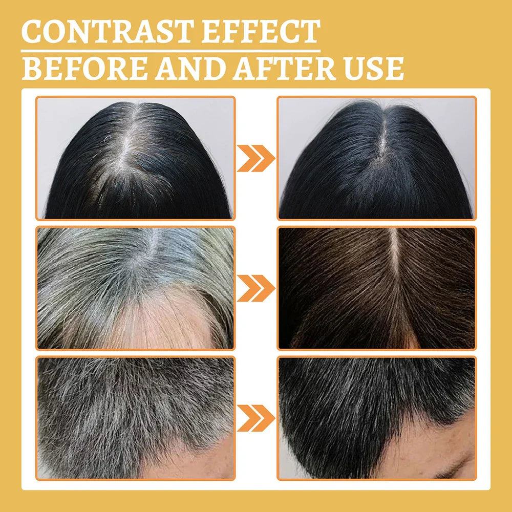 New Repair Damage Anti-Hair Sercum Gray Hair Care