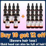 Oil Hair Growth Products for Man Women Ginger