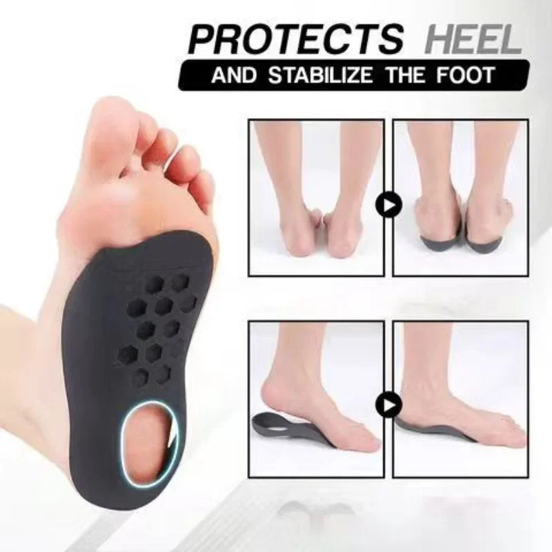 Orthopedic Insoles XO-Legs Orthotics Flat Foot Health Sole