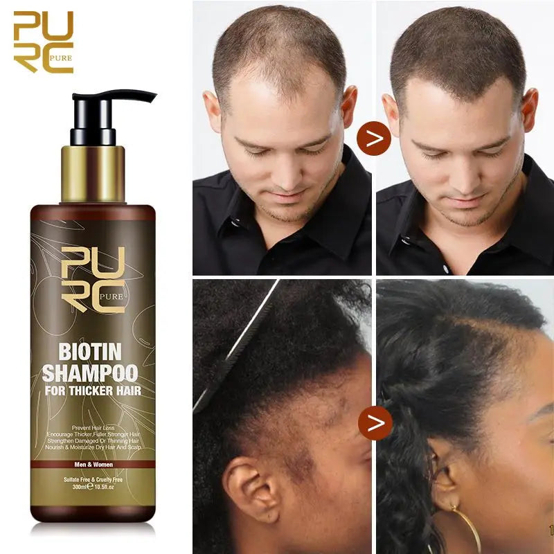 PURC Fast Hair Growth Products for Men Biotin