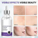 Pore Skin Care Serum Facial Essence for Shrinking