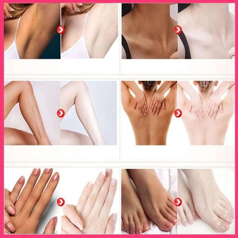 Private body whitening cream armpit buttock nipple private