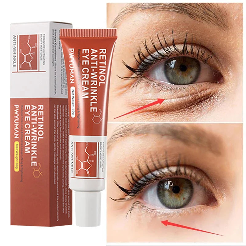 Retinol Anti-Wrinkle Eye Cream Anti Puffiness Remove Eye