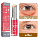 Retinol Anti-Wrinkle Eye Cream Remove Eye Bags Dark