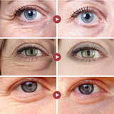 Retinol Anti-Wrinkle Eye Cream Remove Eye Bags Dark