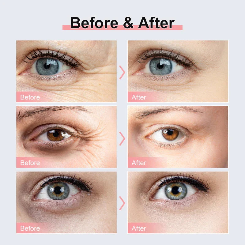 Retinol Eye Cream Stick Dark Circles Eye Bags