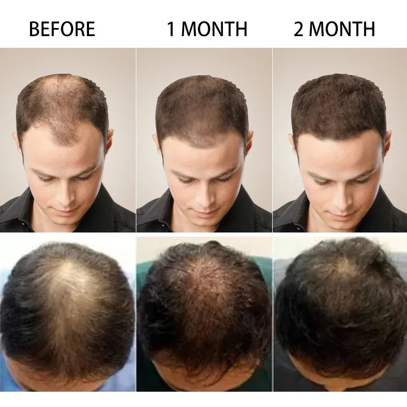 7 Days Fast Ginger Hair Growth Serum Anti-loss