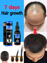 Hair growth essence can quickly grow hair and