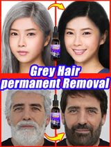 Natural Anti Gray Hair Serum - Repair White