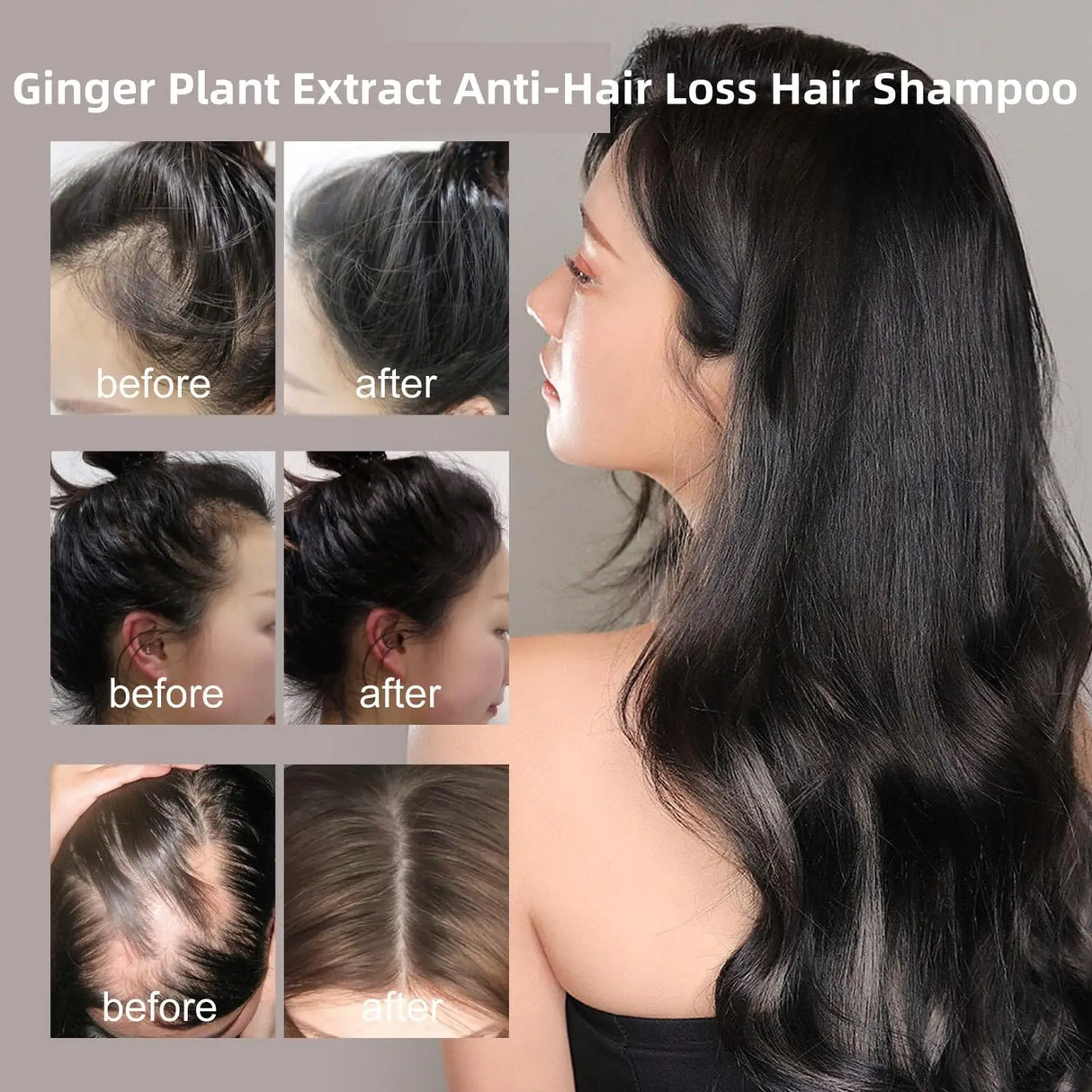 240ml Ginger Plant Extract Anti-Hair Loss Hair Shampoo