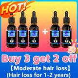 Hair growth essence can quickly grow hair and