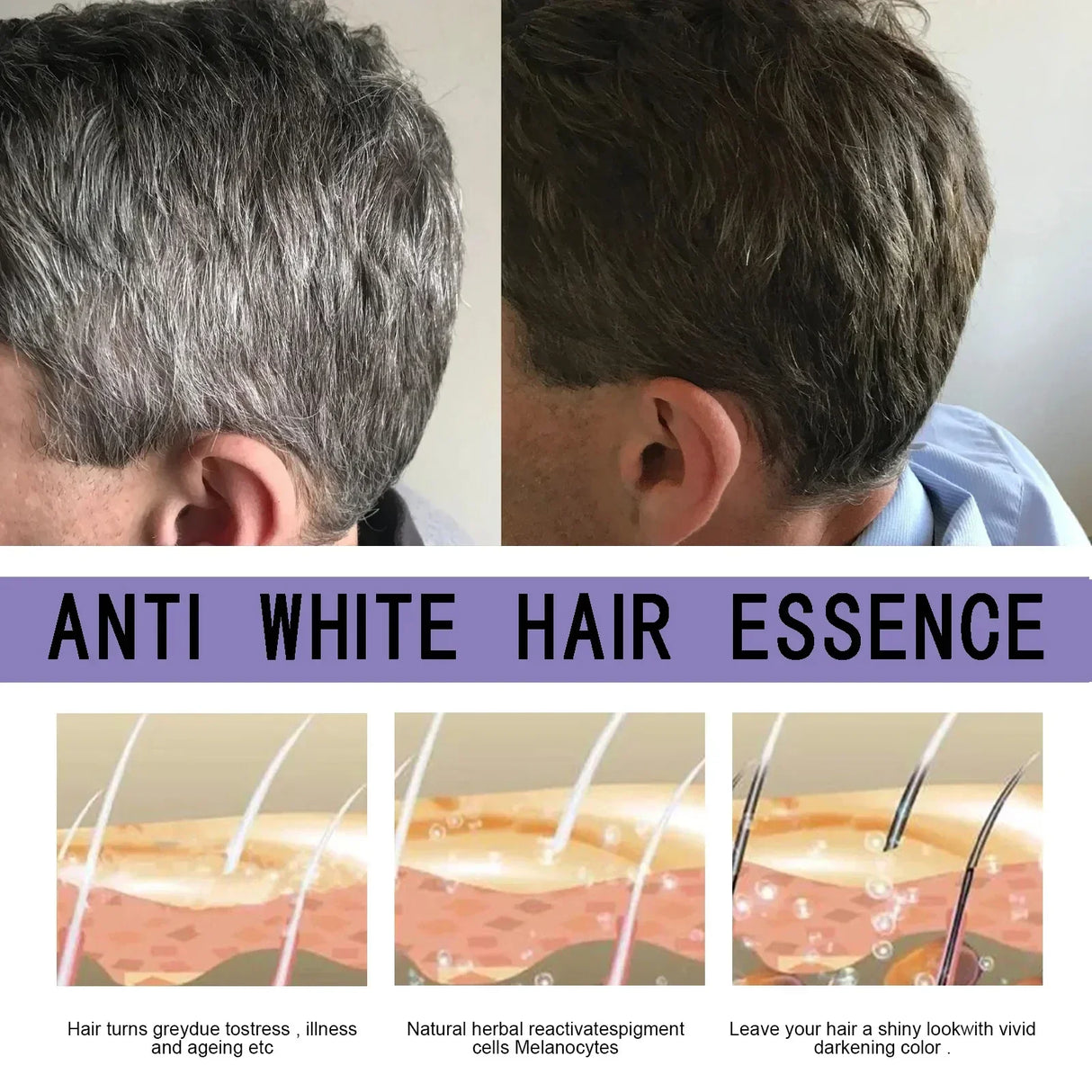 Natural Anti Gray Hair Serum - Repair White