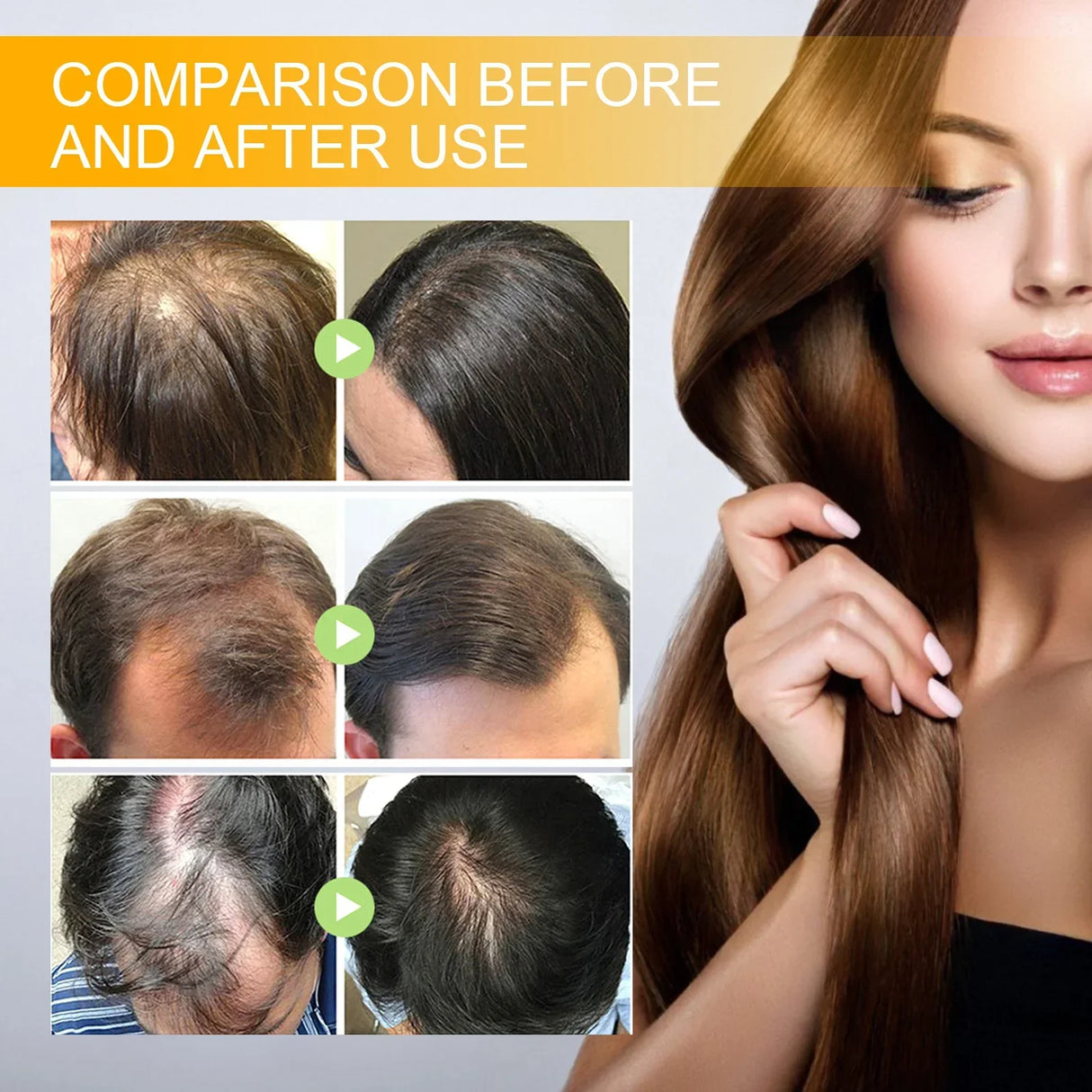 Biotin Fast Hair Growth Products Anti Hair Loss