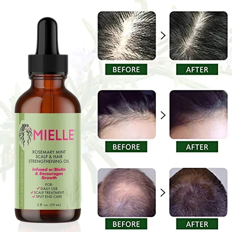 10pcs Organics Mielle Rosemary Mint Hair Growth Essential
