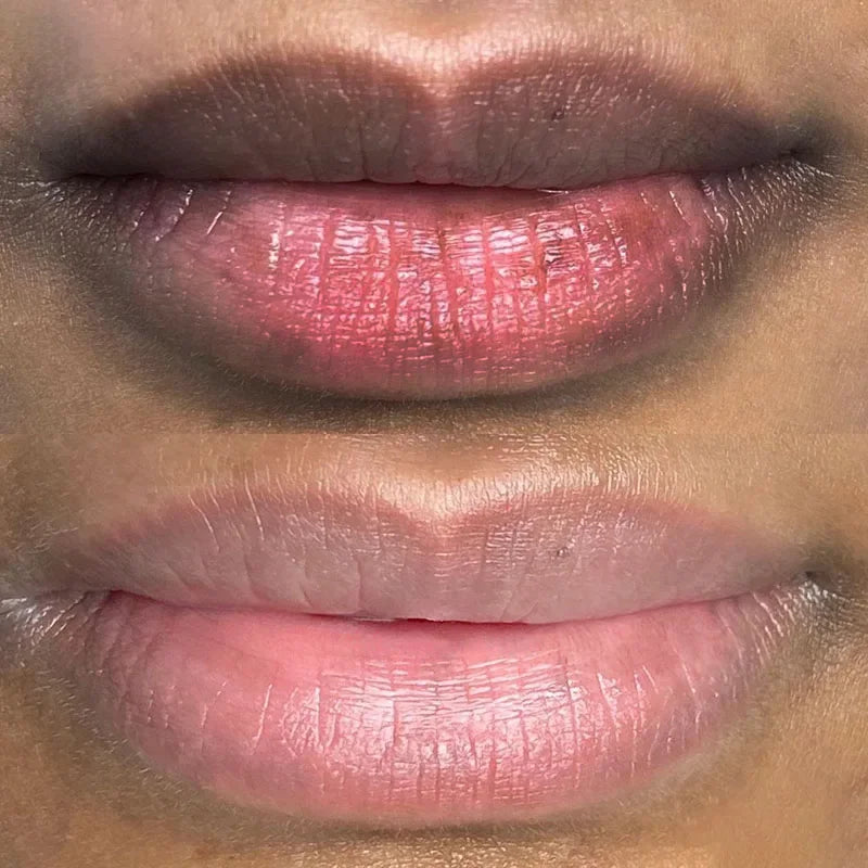 Remove Dark Lip Balm Lightening Melanin Lip Gloss