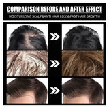 Fast Hair Growth Hair Follicle Treatment Hair Growth