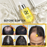 Fast Hair Growth for Men Women Ginger Grow