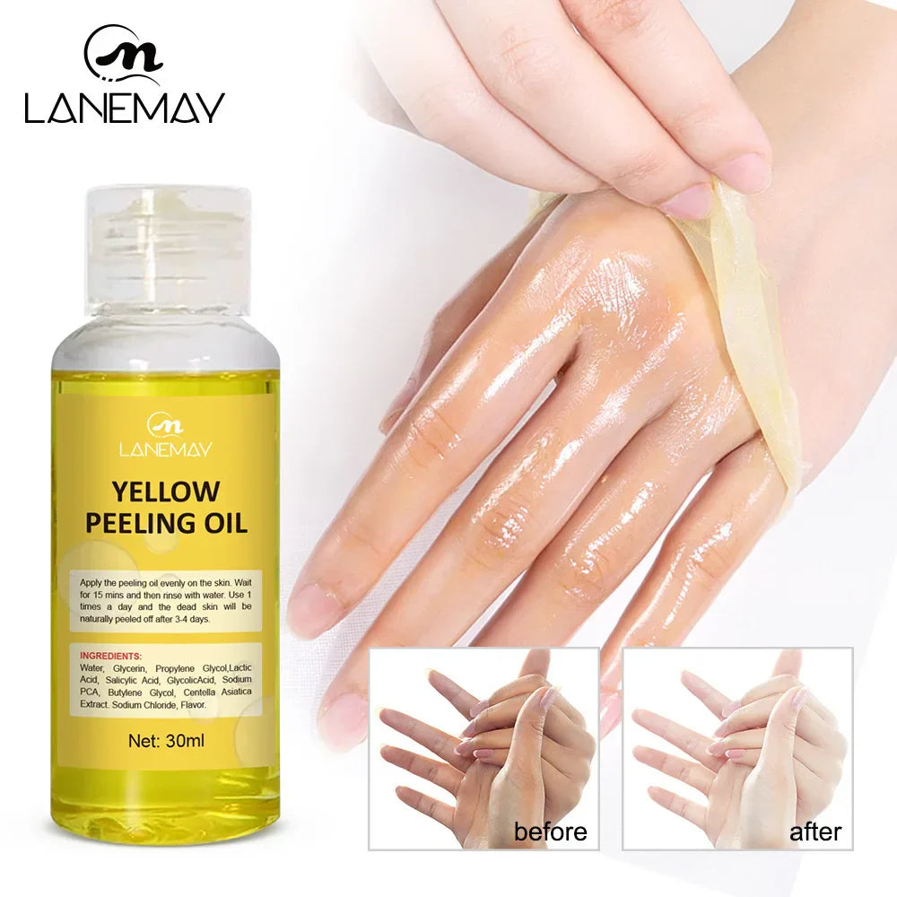 Yellow Peeling Oil Dark Skin Bleaching Remove Arm