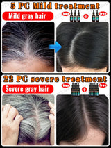 Anti-grey hair essence, restore natural hair color and
