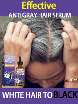 Natural Anti Gray Hair Serum - Repair White