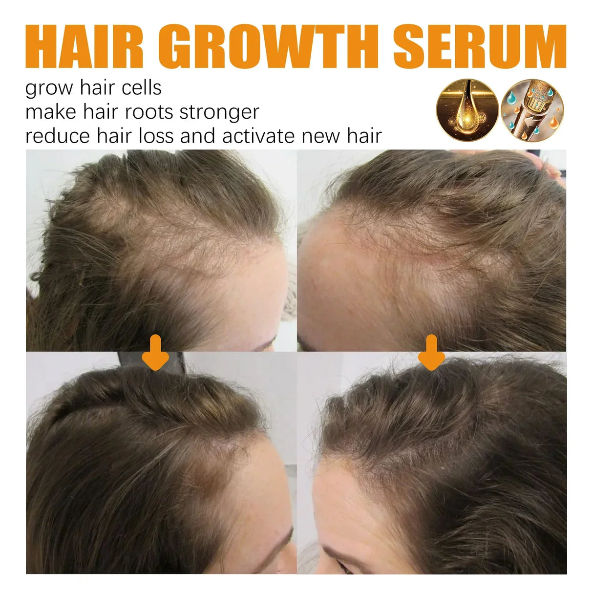 Biotin Fast Hair Growth Products Anti Hair Loss