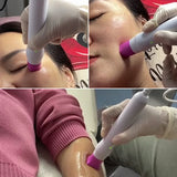 3 In 1 Face Lift Machine Facial RF