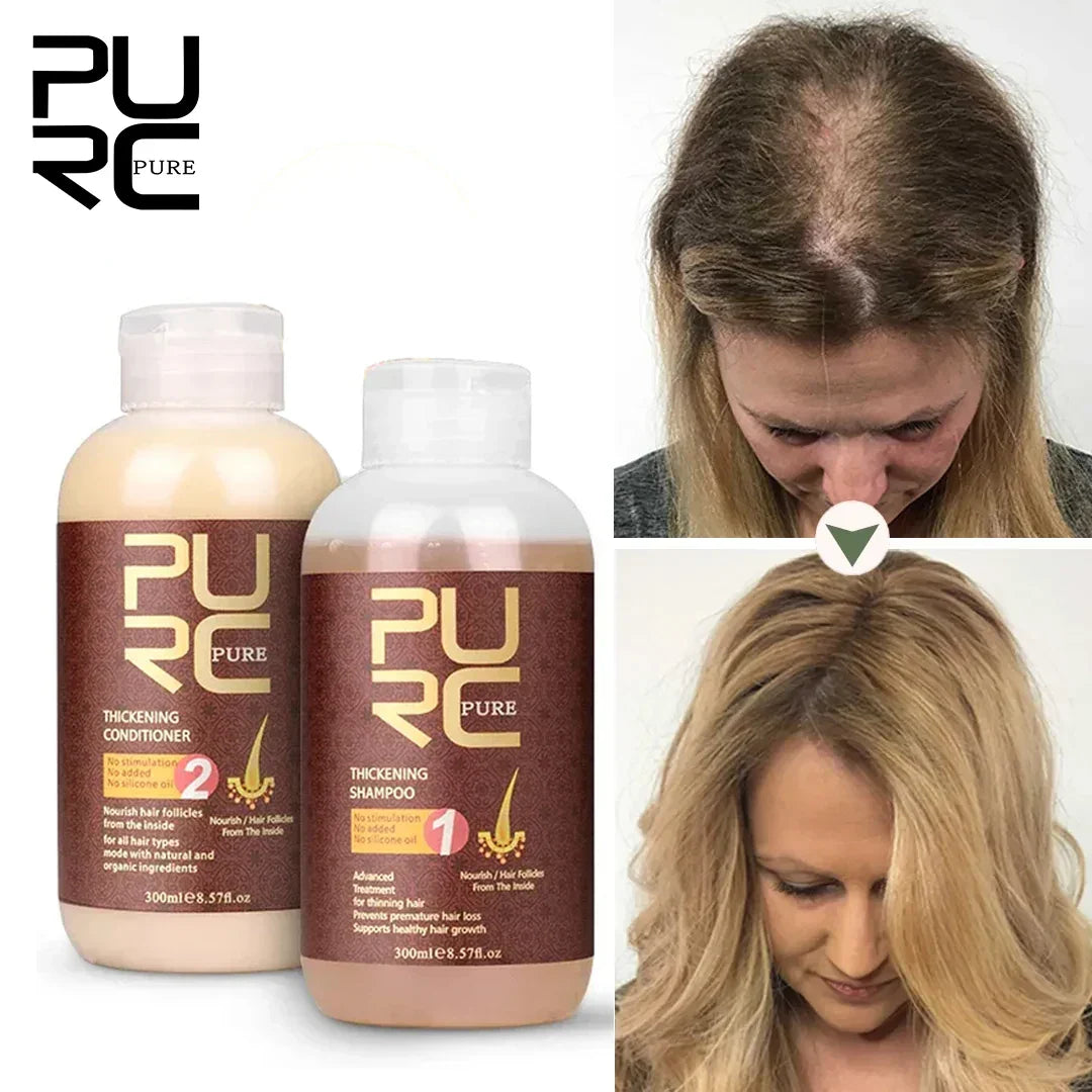 PURC 300ML Ginger Shampoo Set Anti Hair Loss