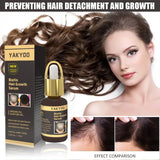 Fast Hair Growth Hair Follicle Treatment Hair Growth