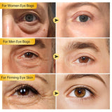 2/3/5/10 PCS Eye Cream Eye Bags Removal Under