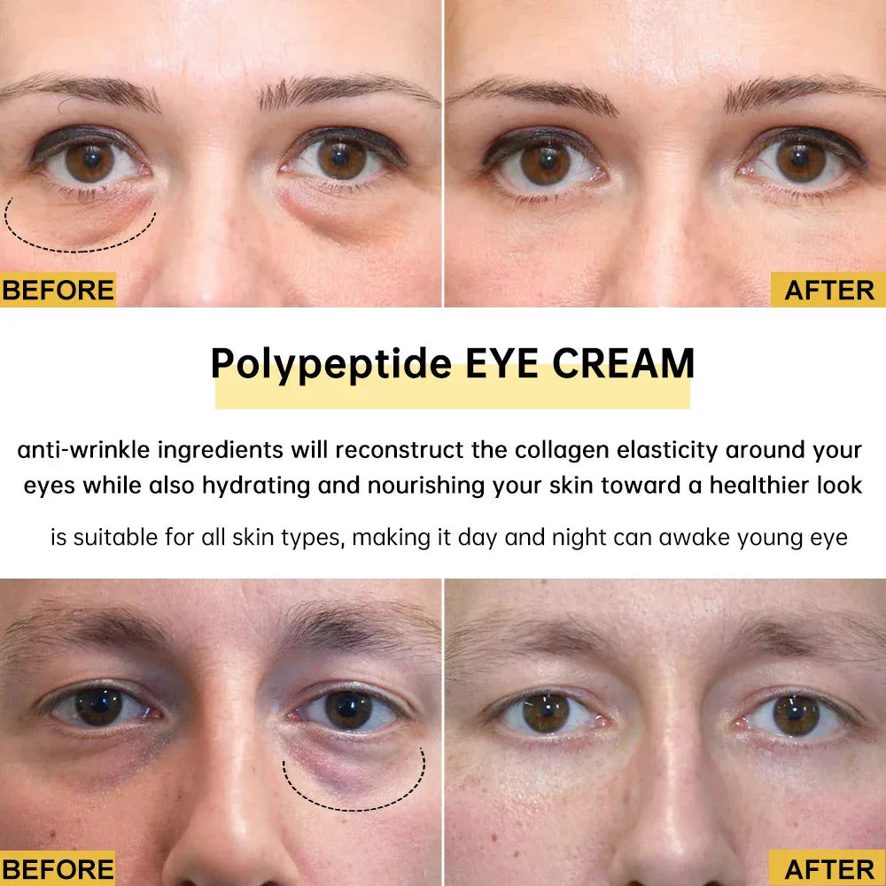 2/3/5/10 PCS Eye Cream Eye Bags Removal Under