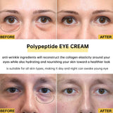 2/3/5/10 PCS Eye Cream Eye Bags Removal Under