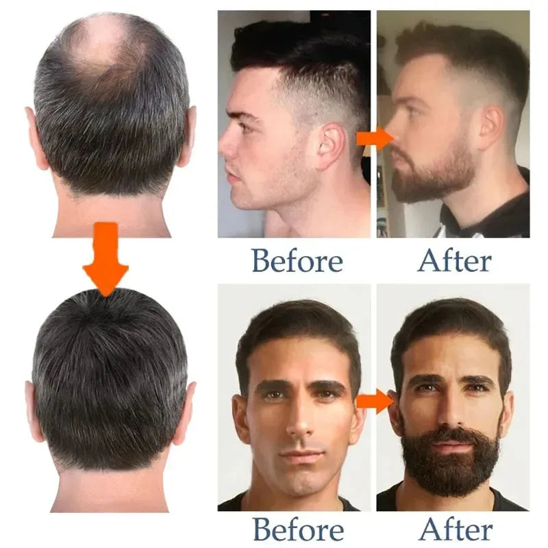 Beard Growth Serum Spray Fast Styling Hair Growing