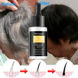 Gray White Hair Treatment Serum Oil White To