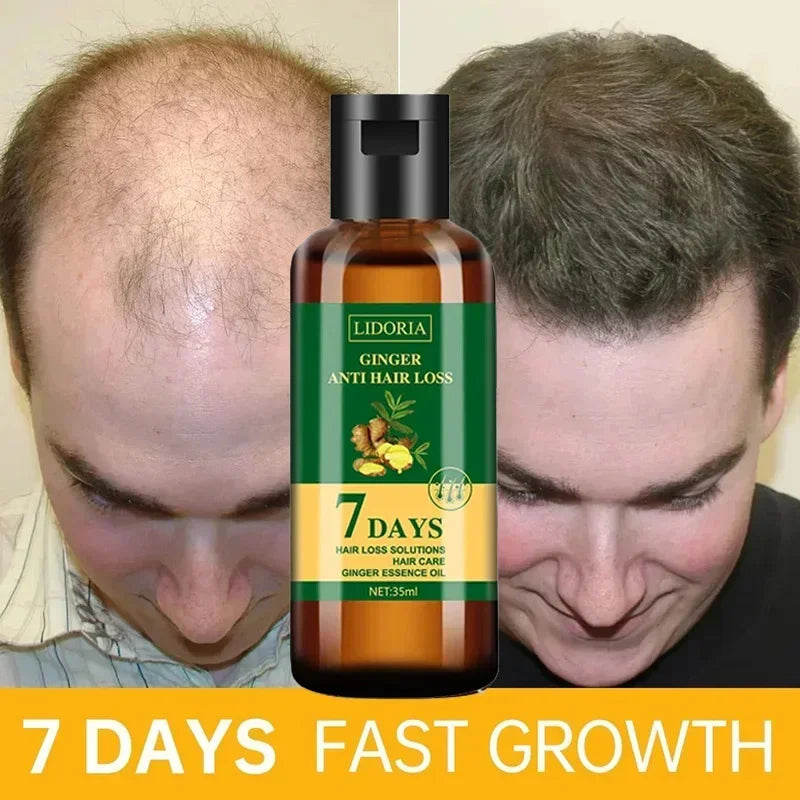 Ginger Hair Growth Essential Oil Anti-loss Hair Regrowth