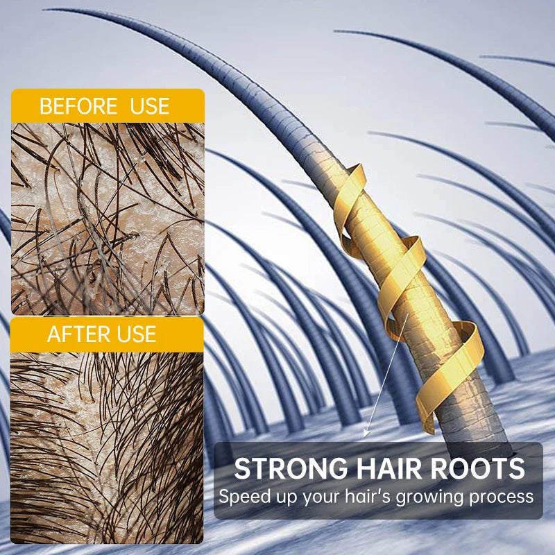 Fast Hair Growth for Men Women Ginger Grow