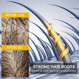 Fast Hair Growth for Men Women Ginger Grow