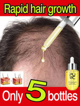 Fast Hair Growth for Men Women Ginger Grow