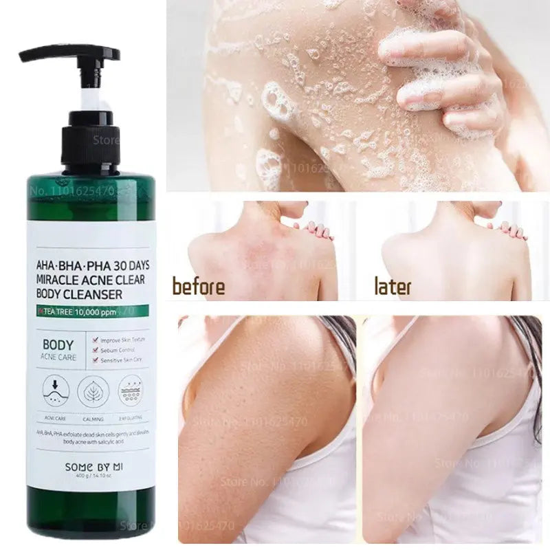 AHA BHA PHA 30 Days Miracle Acne Clear