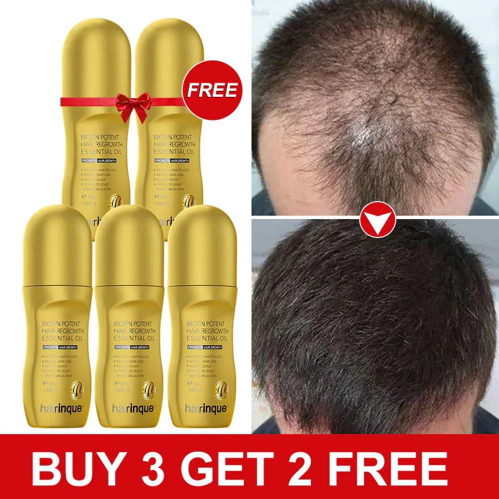 Hairinque Biotin Hair Growth for Men Women Set