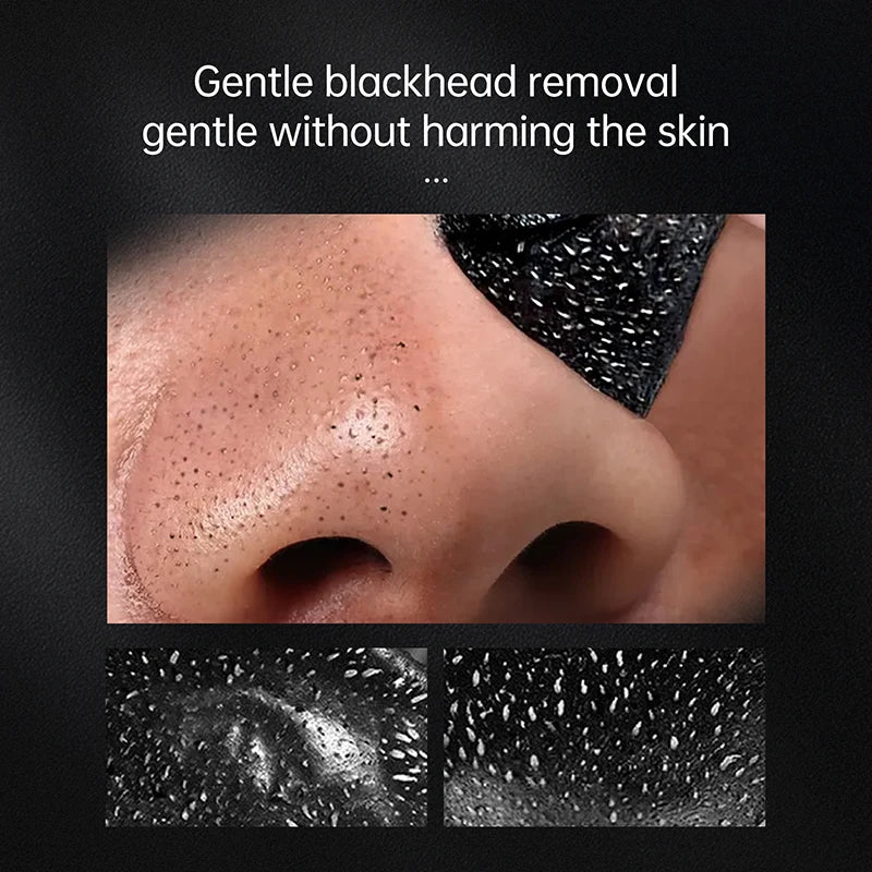 AUQUEST Blackhead Remover Black Dots Facial Masks NoseBamboo