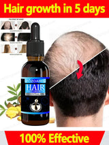 Hair growth essence can quickly grow hair and