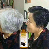 Gray White Hair Treatment Serum Oil White To
