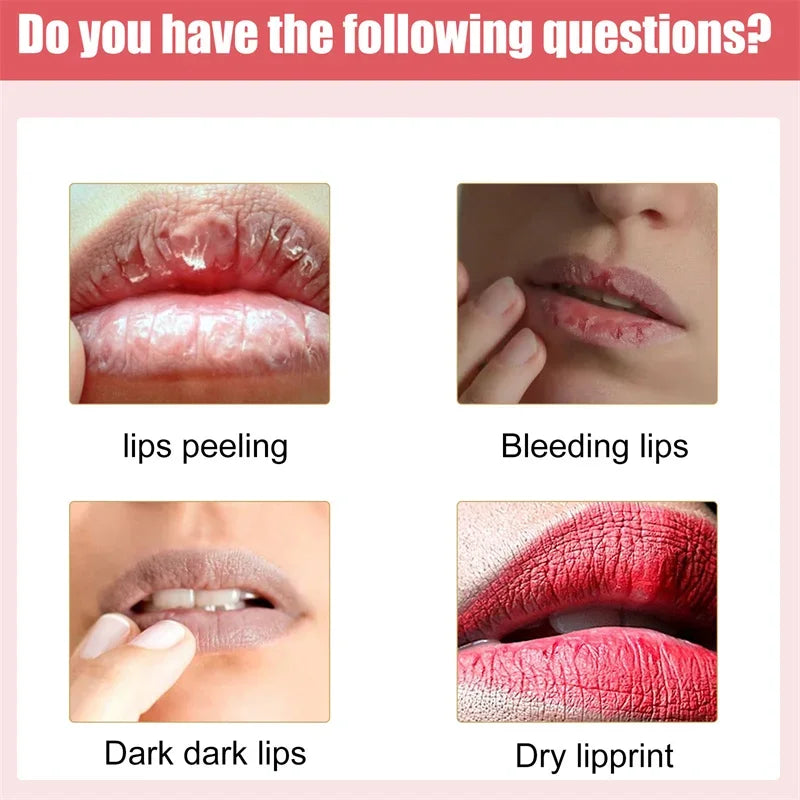 Lips Pink Fresh Whitening Lip Balm Dark Lip