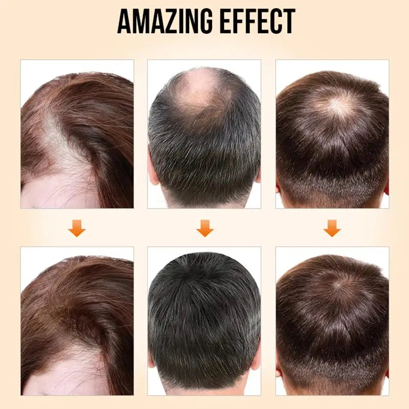 PURC Hair Growth Products for Men Women Ginger