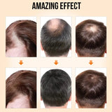 PURC Hair Growth Products for Men Women Ginger